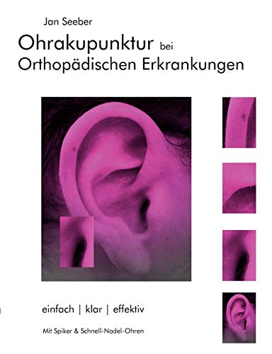 Ohrakupunktur bei Orthopädischen Erkrankungen: Balancierte Ohrakupunktur: einfach, klar, effektiv